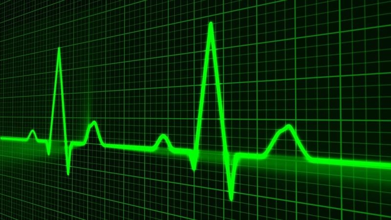 pulse-trace